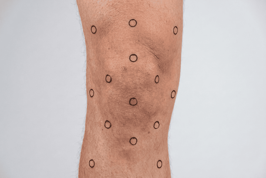 Knee with 12 pressure points
